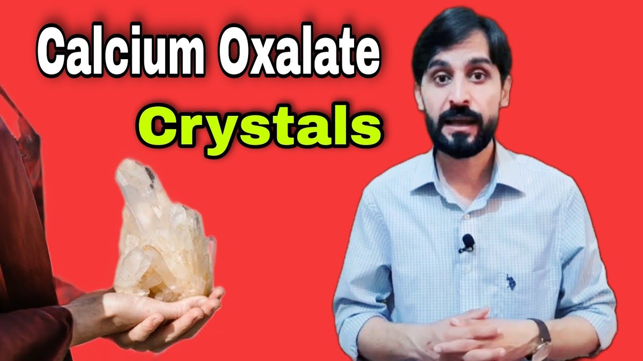 Calcium Oxalate Crystals in Urine | What are Calcium Oxalate Crystals | Causes-Treatment-Prevention