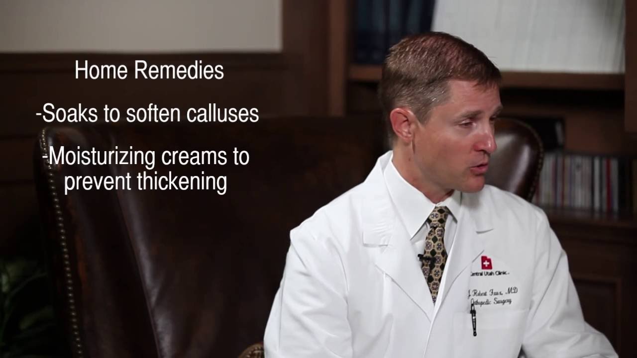 Corns and Calluses Information and Treatment
