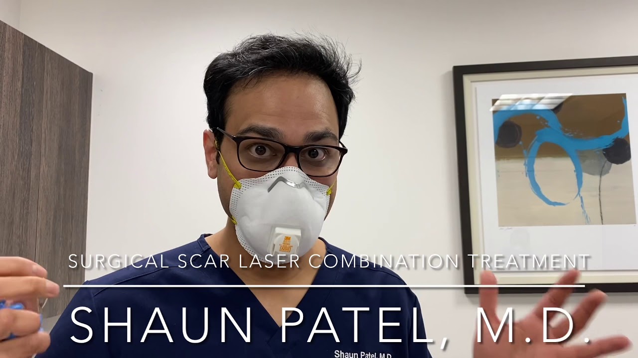 How to treat tummy tuck scar using lasers (VBeam and fractional CO2) and topical steroid