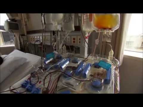 Bone Marrow Transplant - Mayo Clinic