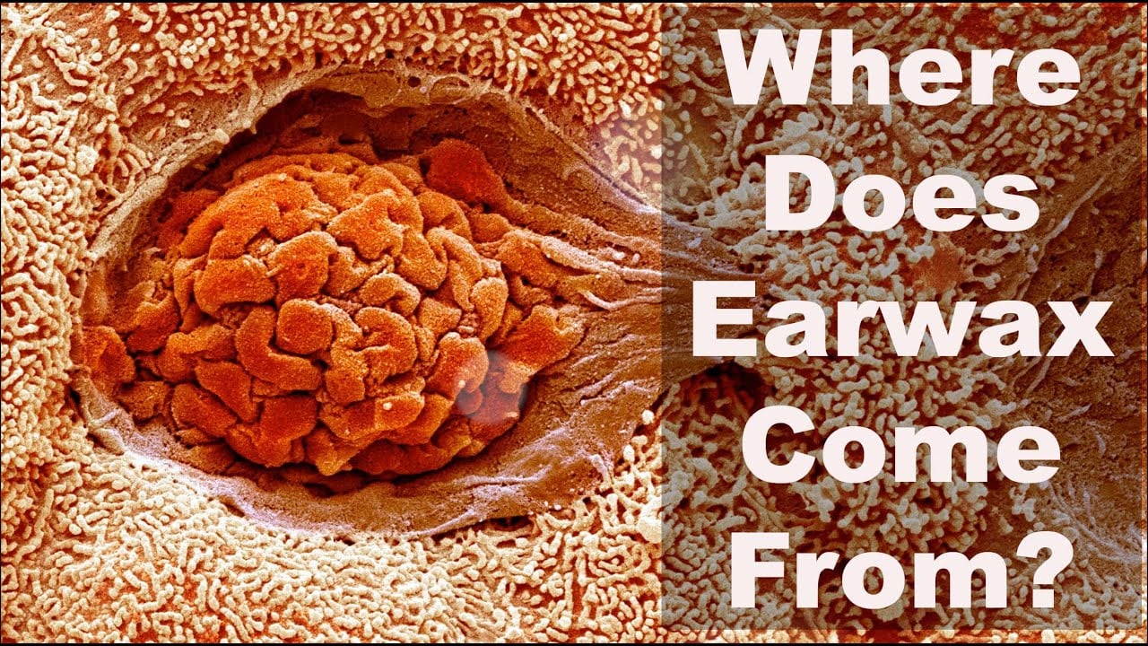 Where Does Earwax Come From?