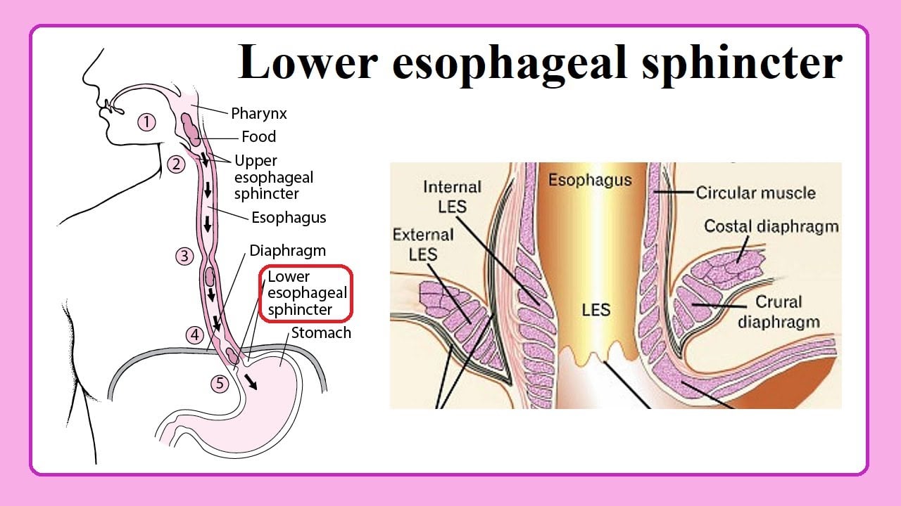 lower esophageal sphincter