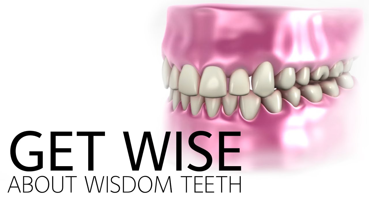 Get Wise About Wisdom Teeth