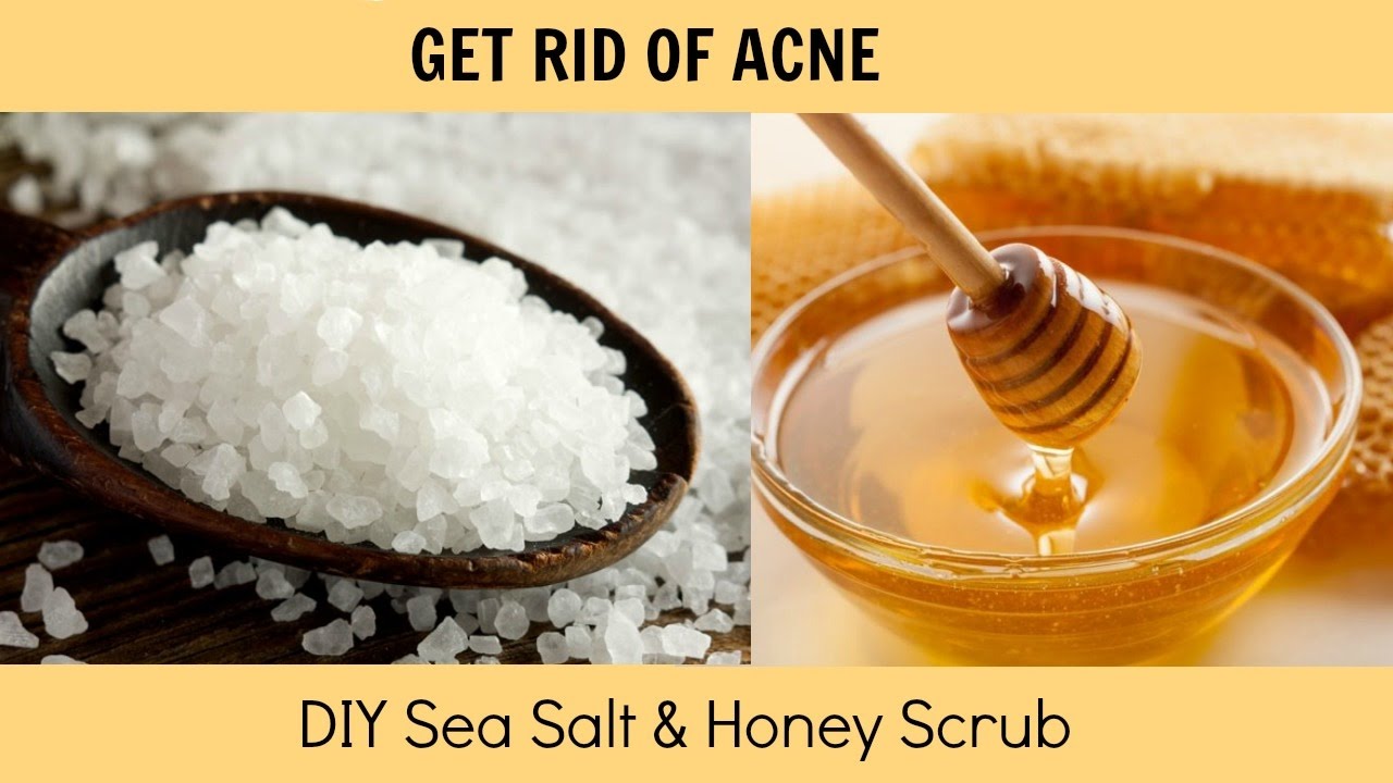 HOW TO: GET RID OF ACNE! | DIY Sea Salt & Honey Scrub