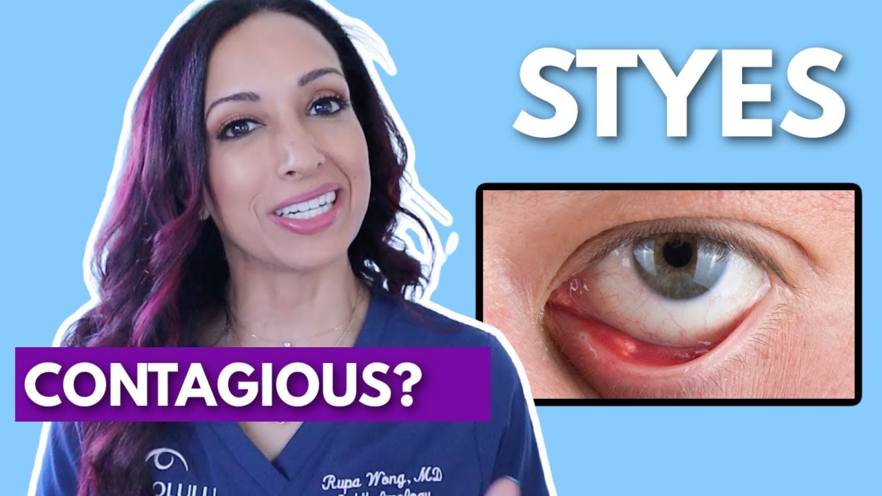 Are Styes Contagious? Eye Doctor Debunks