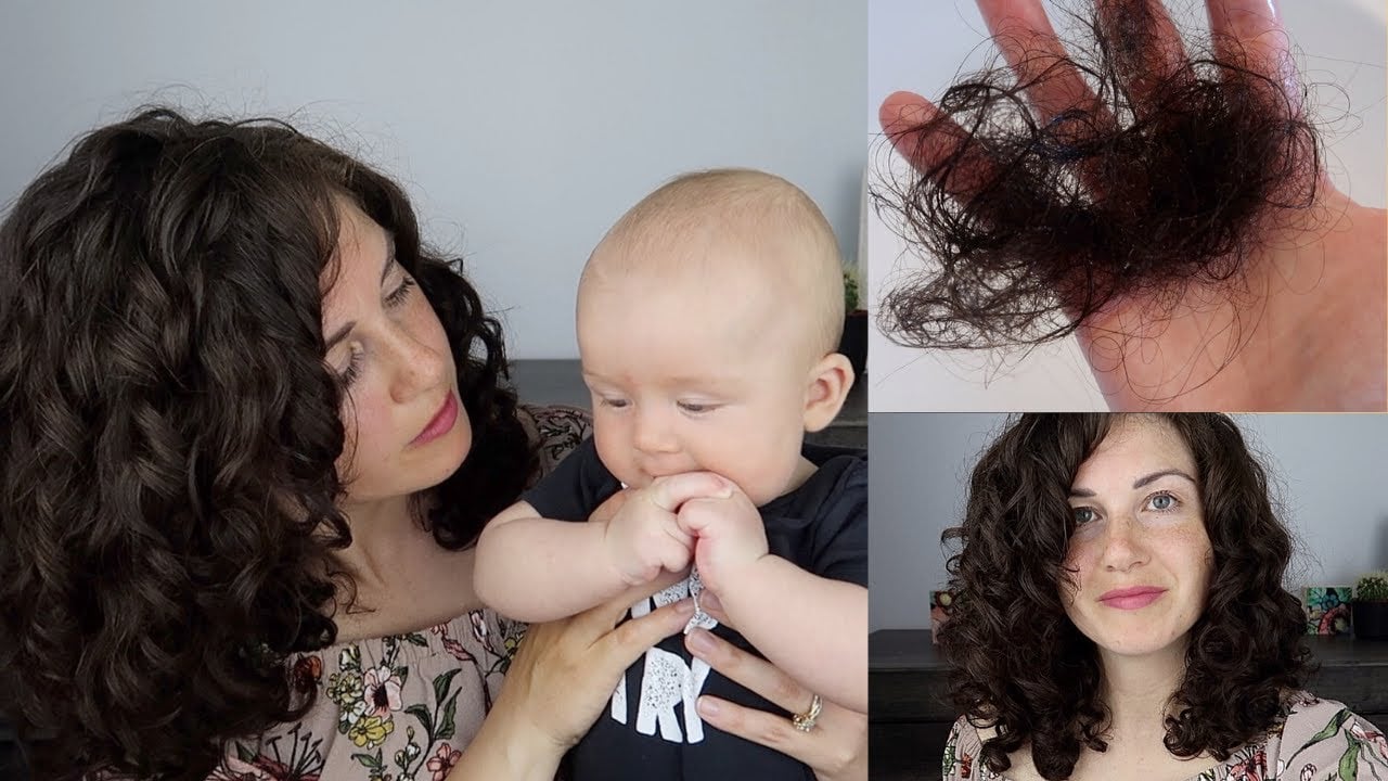 Post Partum Hair Loss | What to do/What NOT to do!