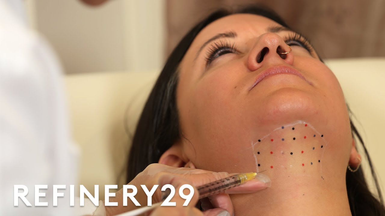 Kybella Double Chin Removal Treatment Up Close | Macro Beauty | Refinery29