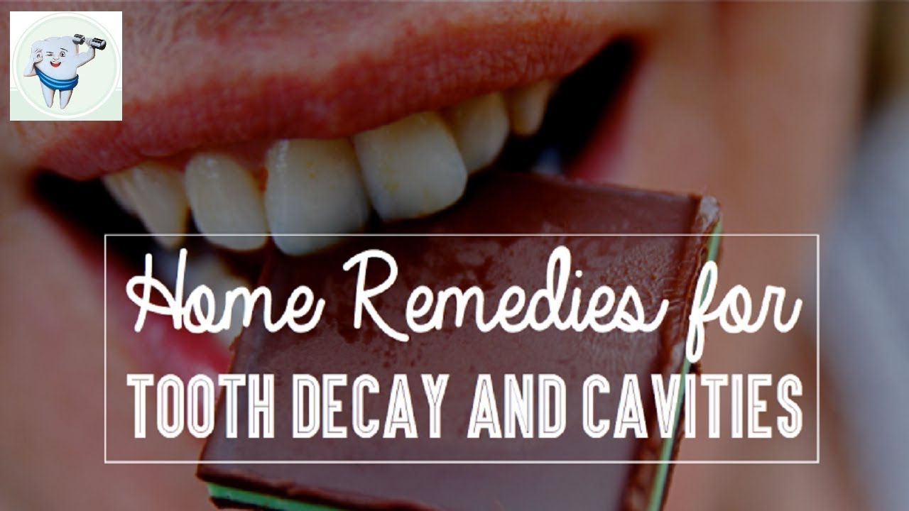 How To Heal Tooth Decay And Cavities Using Home Remedy