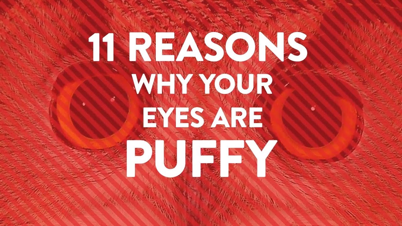 11 Reasons Why Your Eyes Are Puffy | Health