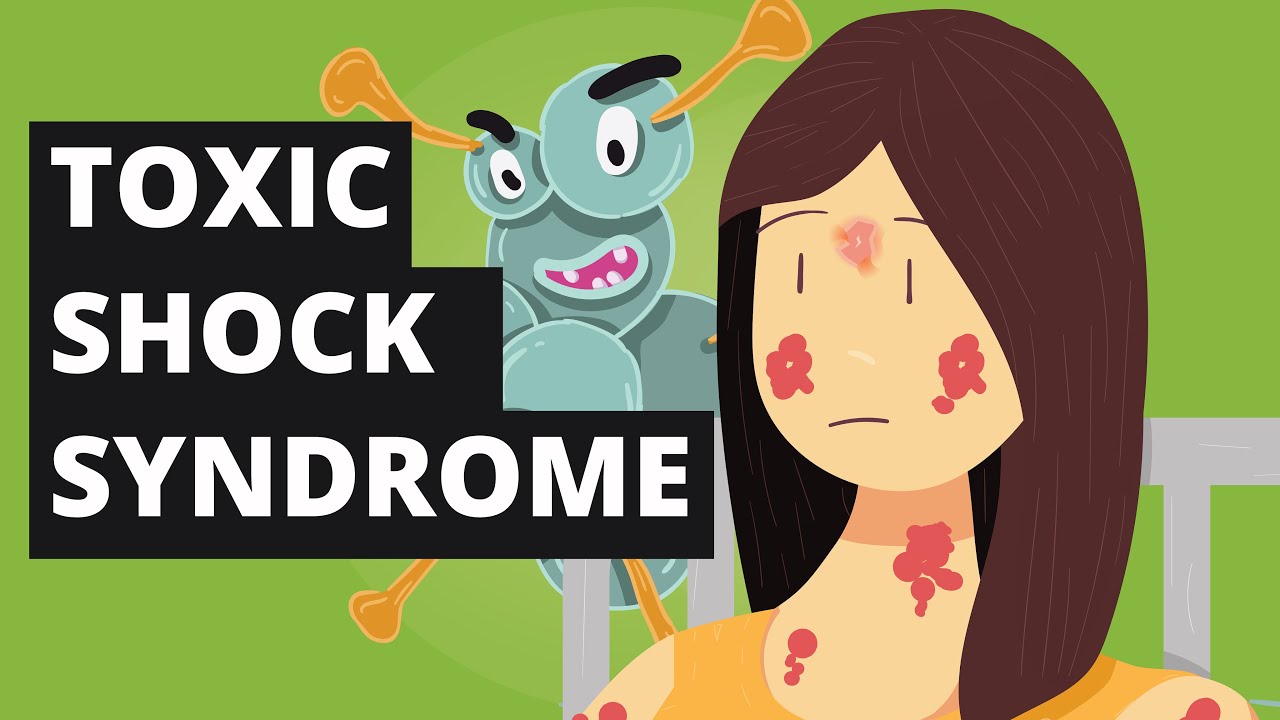 What is Toxic Shock Syndrome? (Tampons Disease)