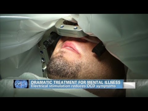 Sanjay Gupta MD: Deep brain stimulation helps OCD patient