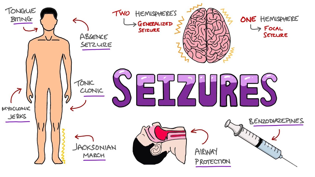 Seizures - Seizure Types | Generalized vs Focal Seizures | Causes of Seizures (Mnemonic)