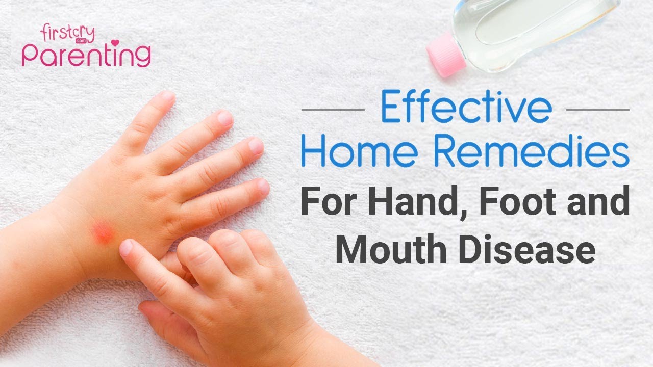 8 Effective  Home Remedies for Hand, Foot, and Mouth Disease in Children