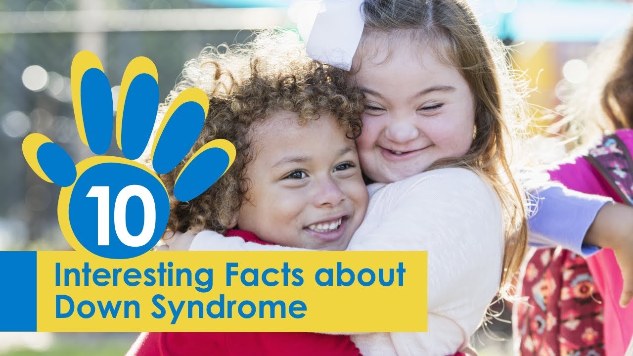 10 Interesting Facts about Down Syndrome