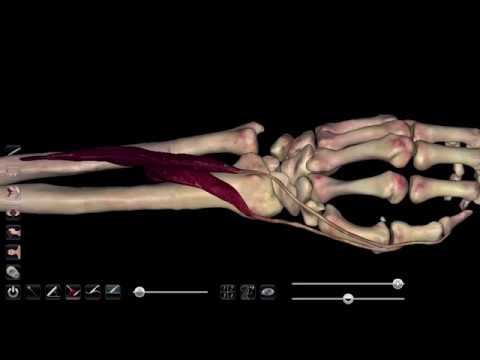 What is Tendonitis?