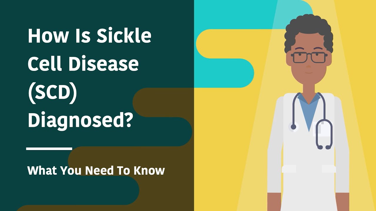 How Is Sickle Cell Disease (SCD) Diagnosed? What You Need To Know