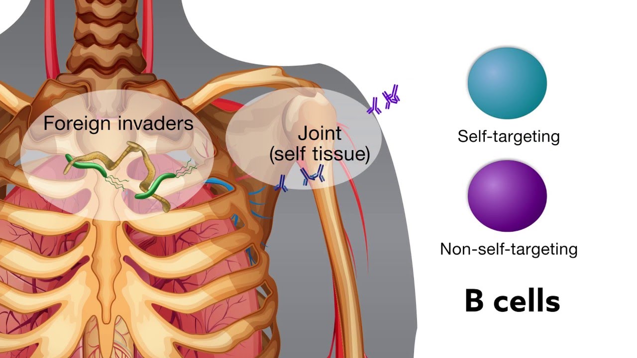 Chronic bacterial infection activates autoreactive B cells