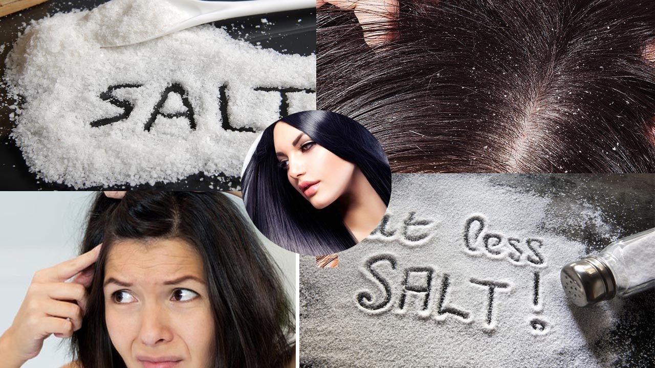 Hair Treatment At Home | How to Get Rid of Dandruff | Salt treat dandruff