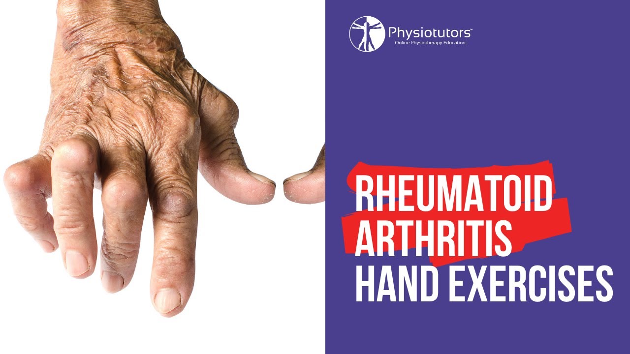Rheumatoid Arthritis Hand Exercises | Mobility & Strength