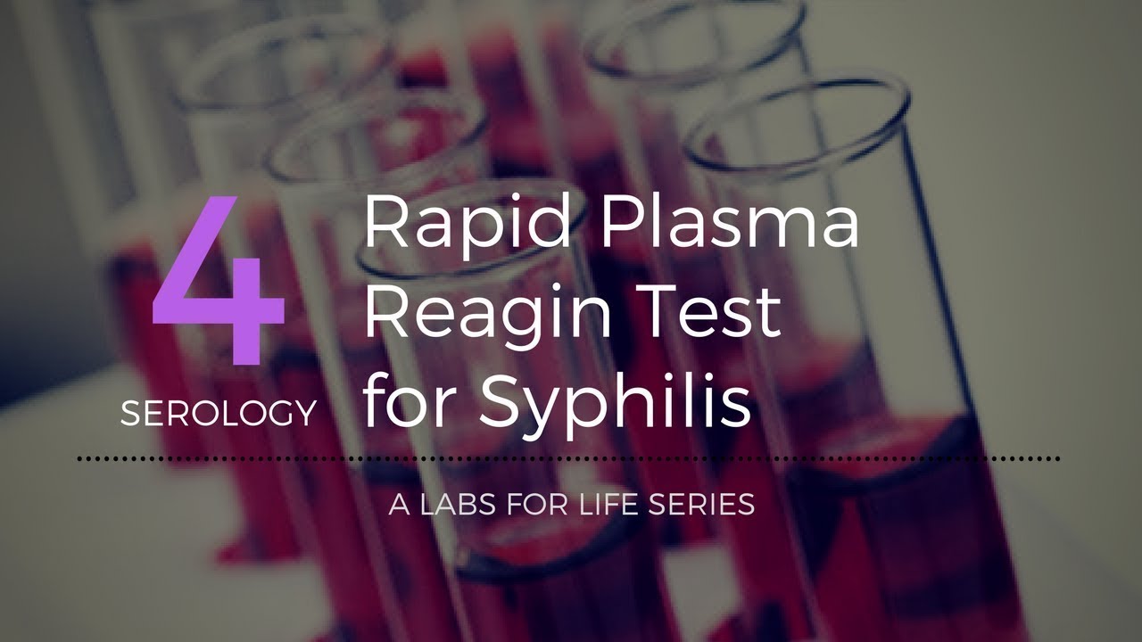 Rapid Plasma Reagin Test for Syphilis