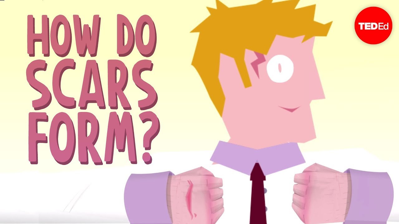 How do scars form? - Sarthak Sinha