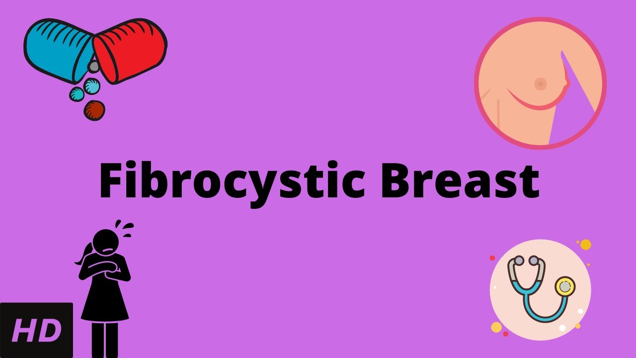 Fibrocystic Breast, Causes, Signs and Symptoms, Diagnosis and Treatment.