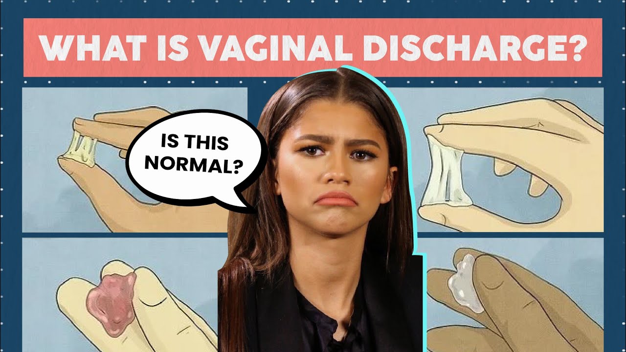 Is White Discharge Before Periods Okay?