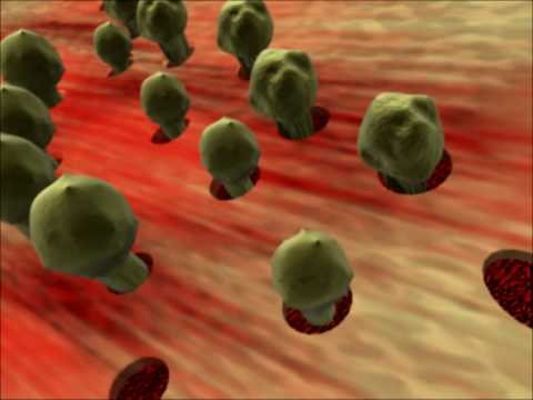 Johns Hopkins Medicine | Aplastic Anemia