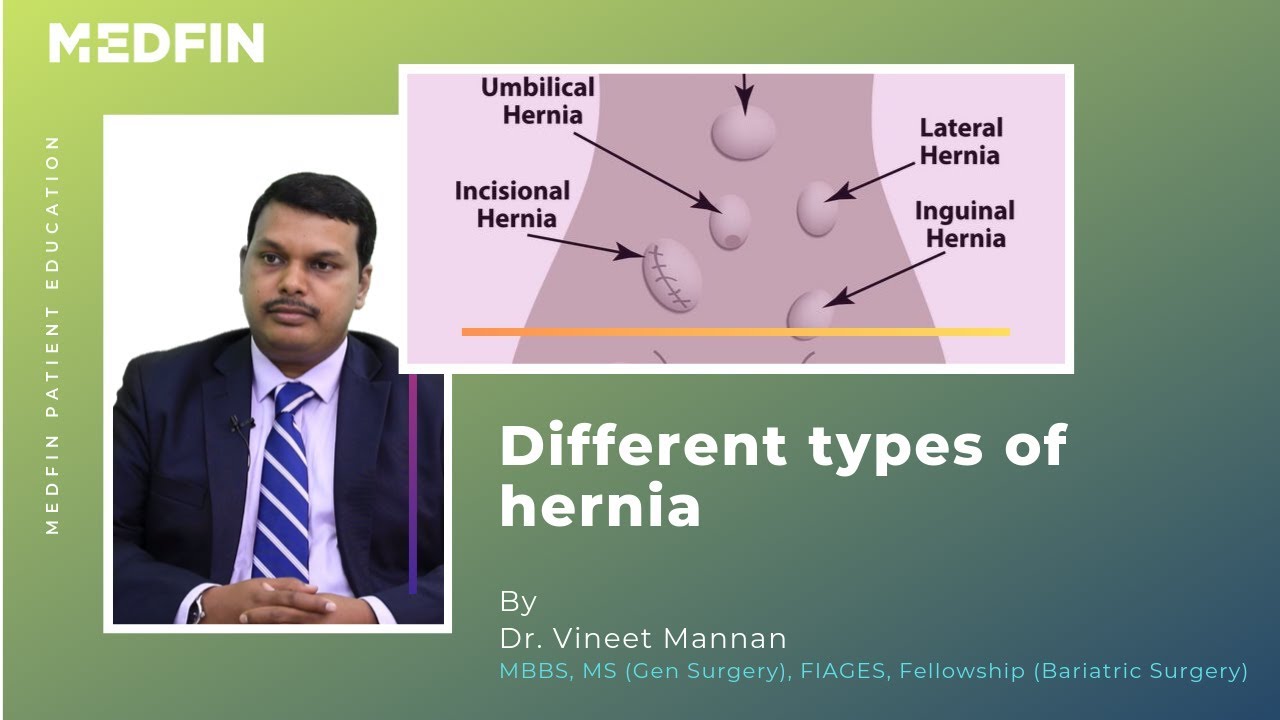 Types of Hernia
