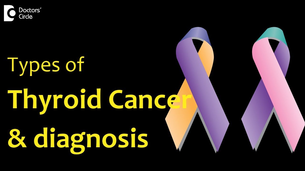 Thyroid Cancer | Types of  thyroid cancer and diagnosis - Dr. Anil Kamath