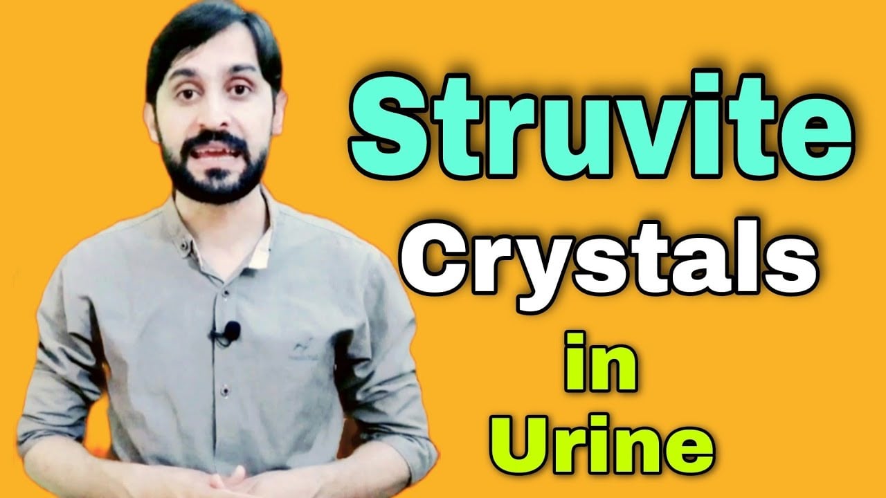 Struvite Crystals in Urine | Struvite Stones | Causes | Diagnosis | Treatment