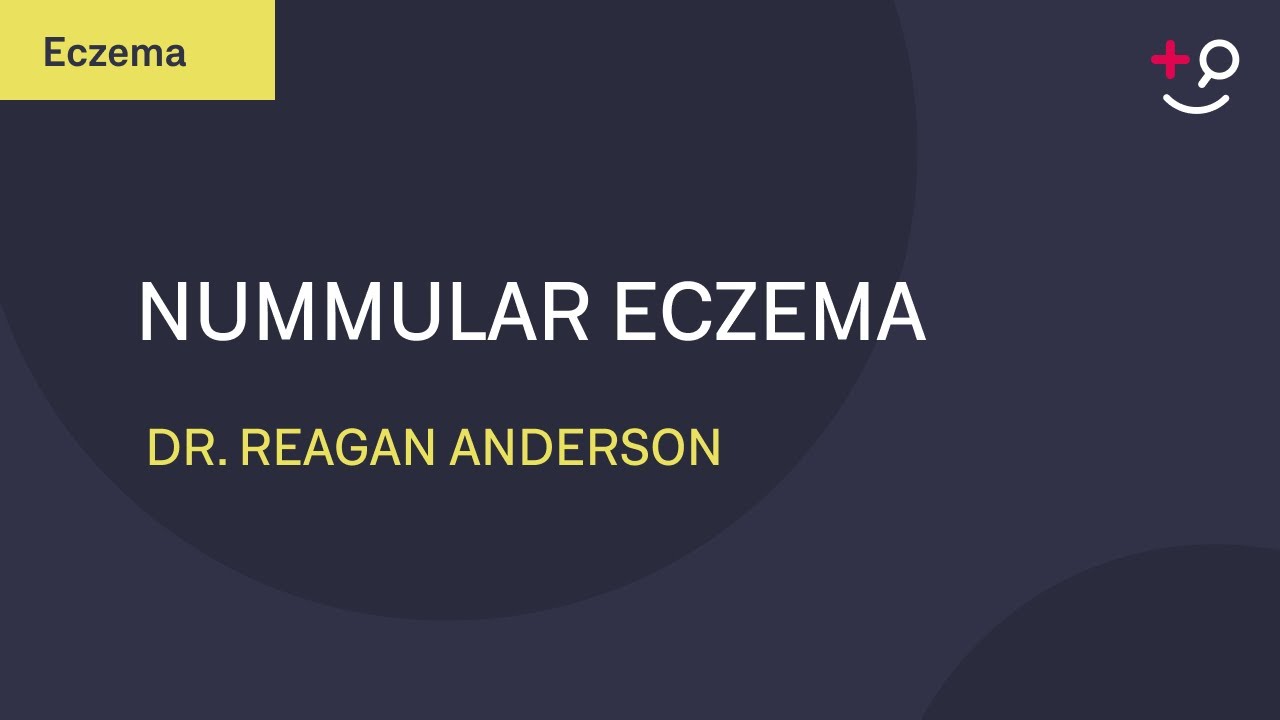 Nummular Eczema - Daily Do's of Dermatology