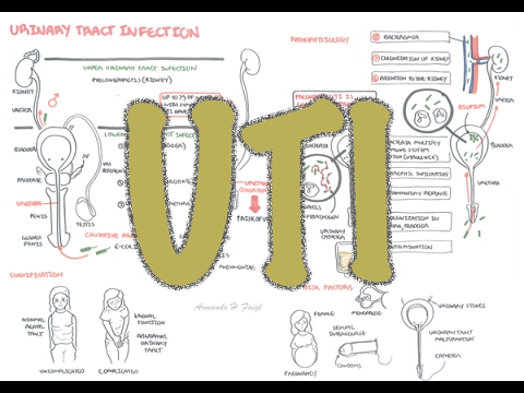 Urinary Tract Infection - Overview (signs and symptoms, pathophysiology, causes and treatment)