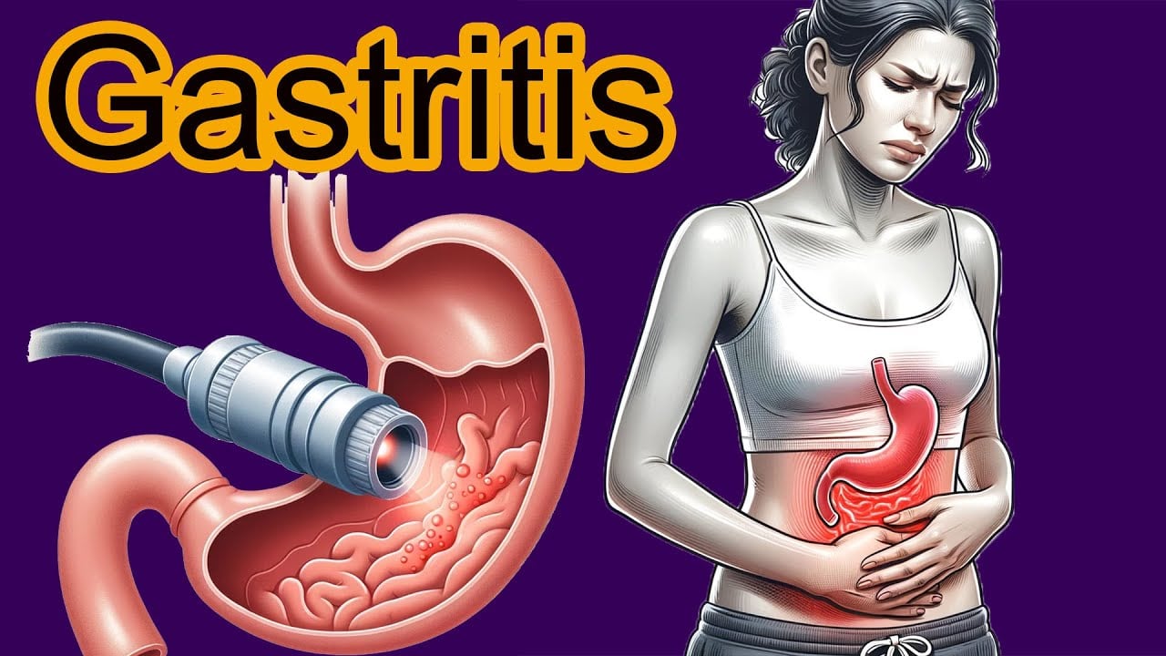 5 Early signs of Gastritis.  Gastritis diagnosis and treatment