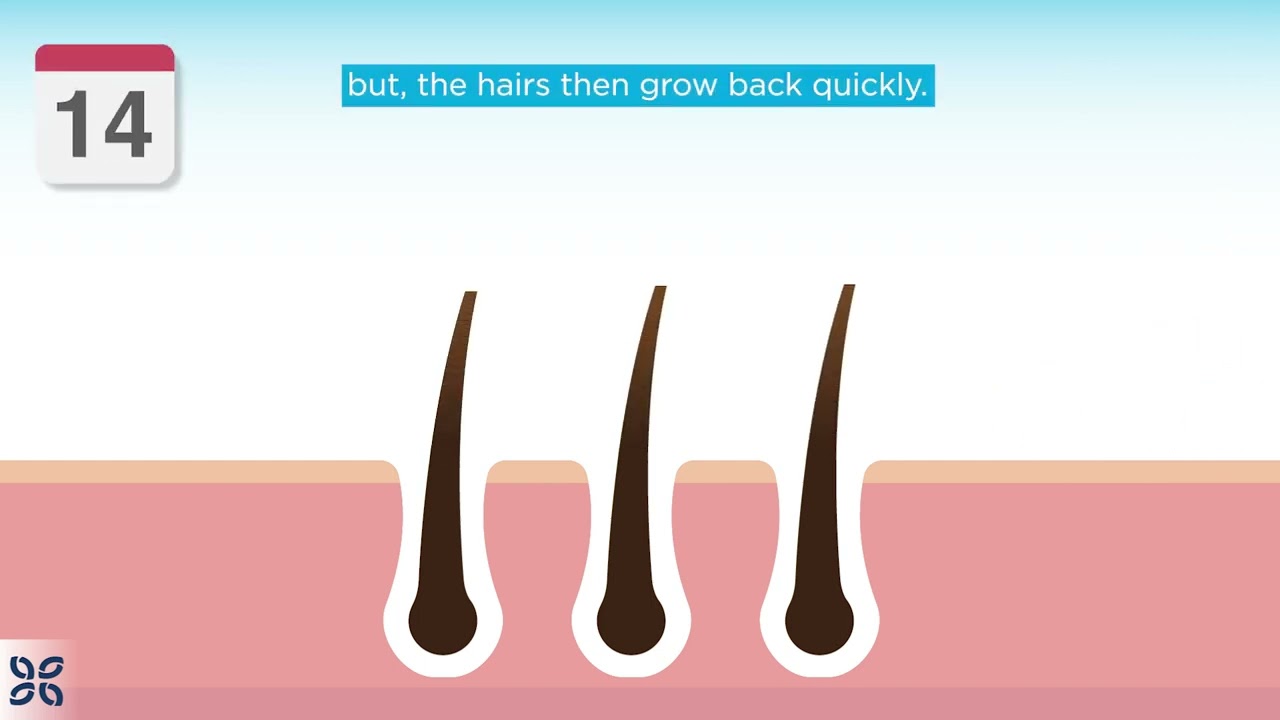 The Cosmetic Clinic Laser Hair Removal Animation