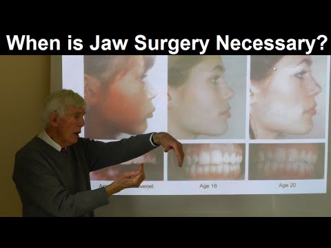 When is Jaw, Oral & Orthognathic Surgery Necessary for Further Treatment by Prof John Mew