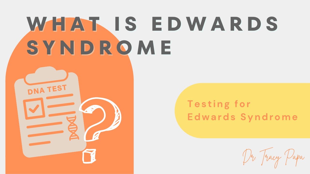 What Is Edwards Syndrome | Testing For Edwards Syndrome