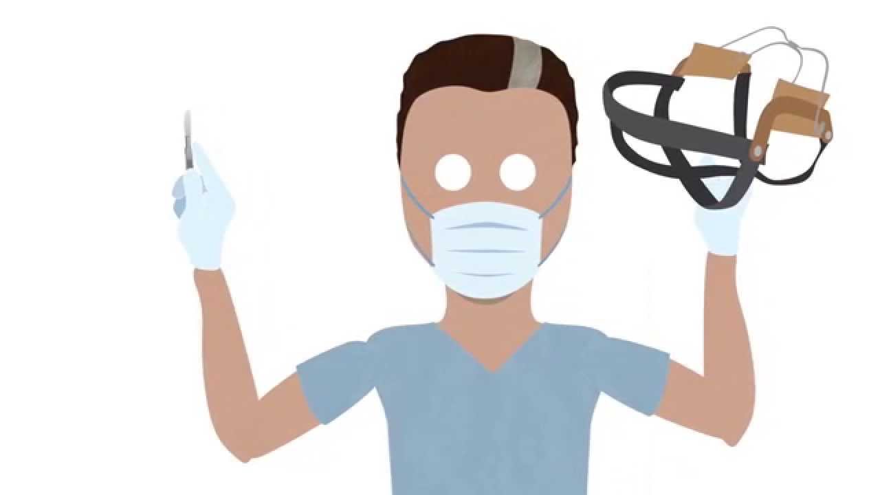 Causes of malocclusion: dental & arch problems