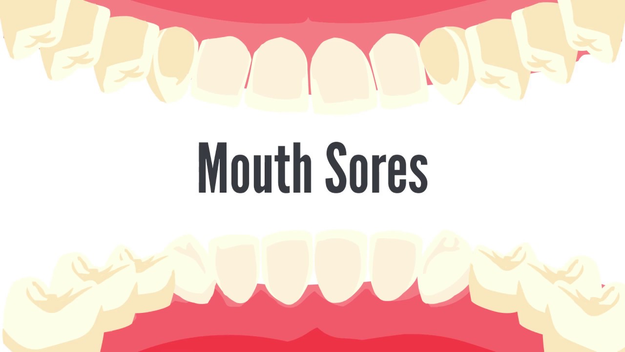 6. Mouth Sores