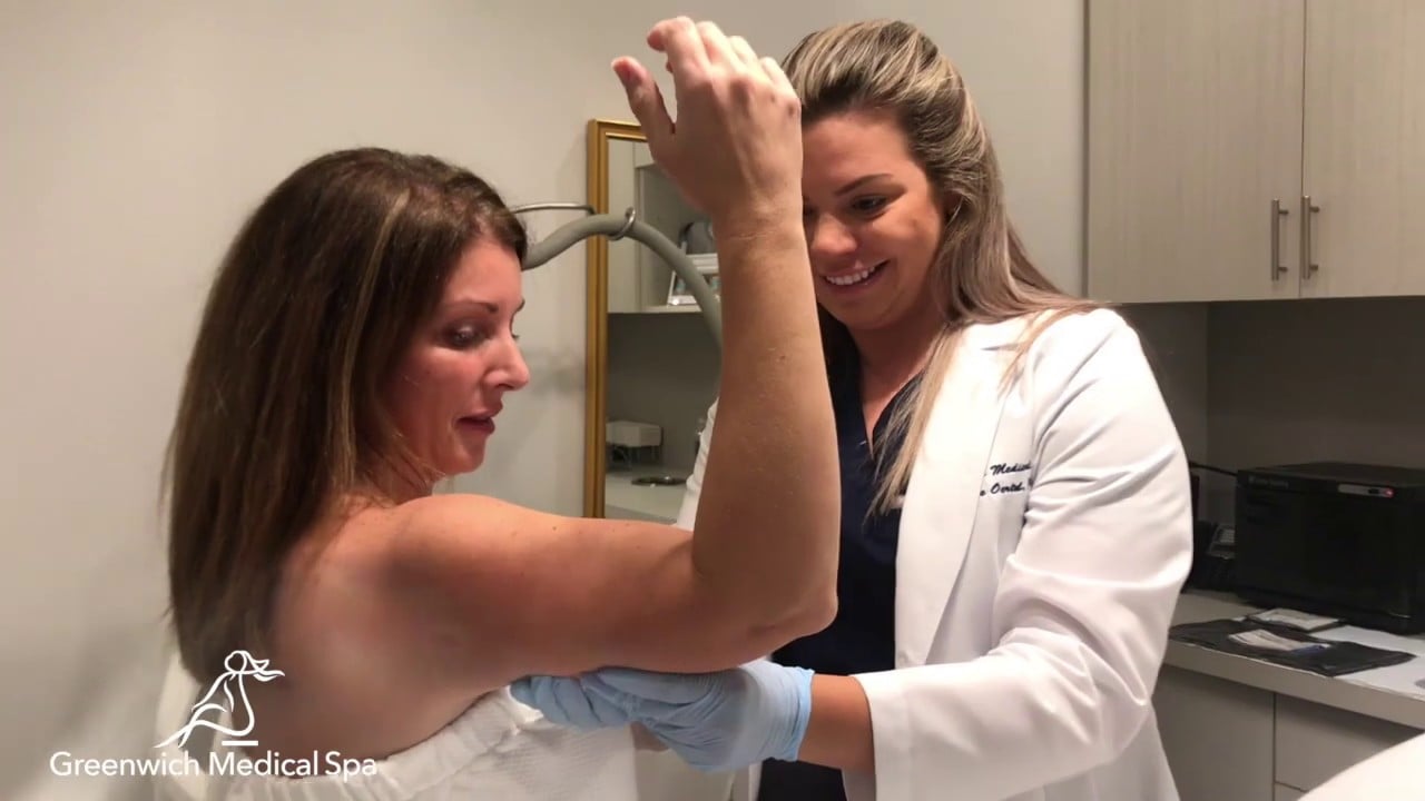 No More Bulky Sweaters To Hide A Bulky You. Coolsculpting For Arms permanently removes fat.