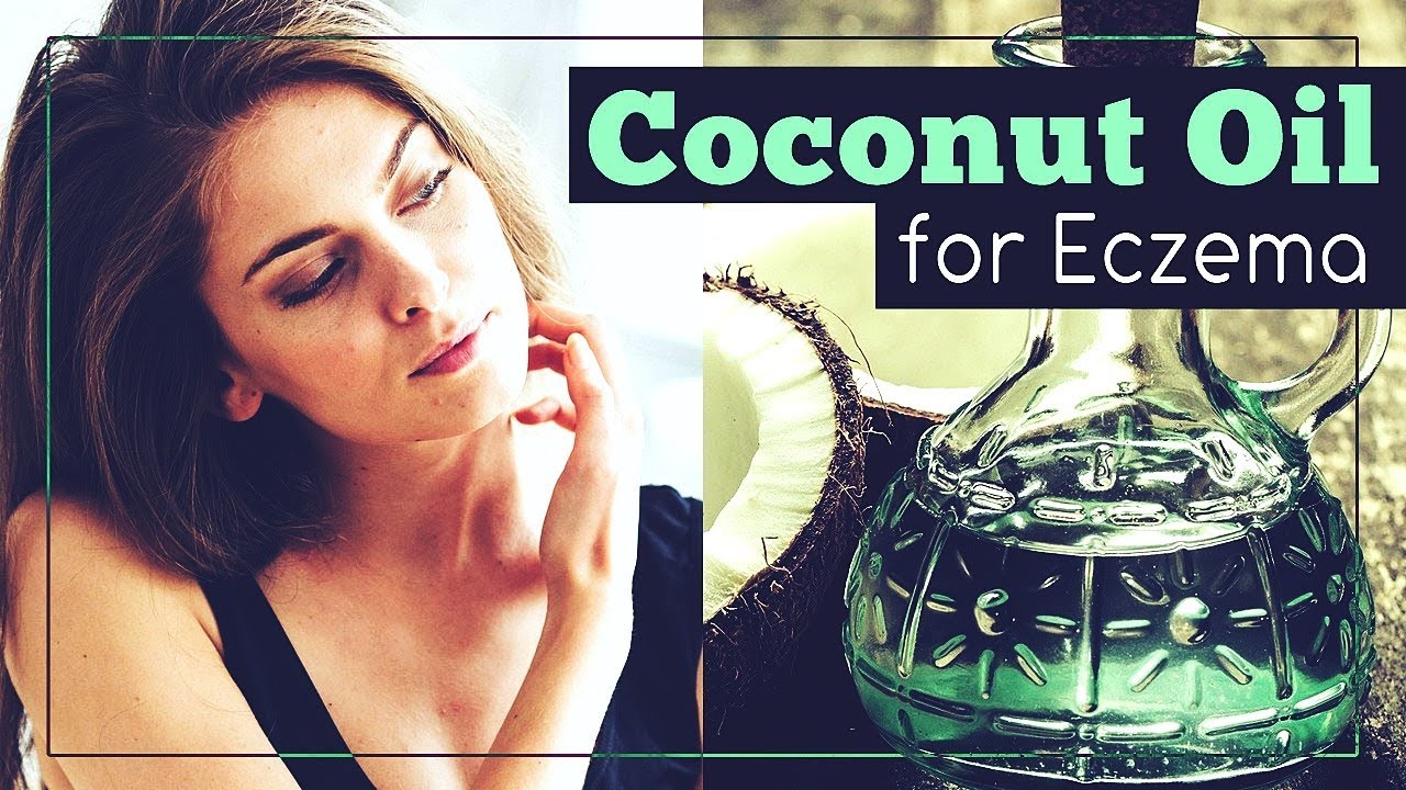 Coconut Oil for Eczema: How to Use It?