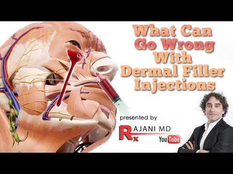 What Can Go Wrong With Dermal Filler Injections-Injection Side Effects
