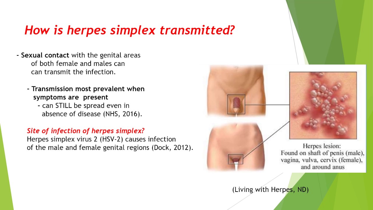 Herpes Simplex (Genital)