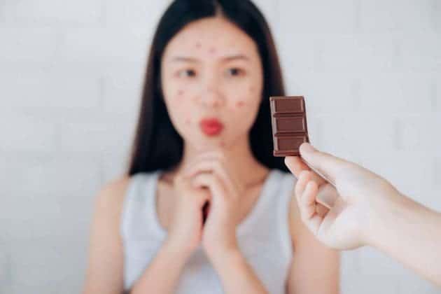Chocolate Allergy Symptoms Severity Reference: A Detailed Guide On Chocolate Allergy Symptoms