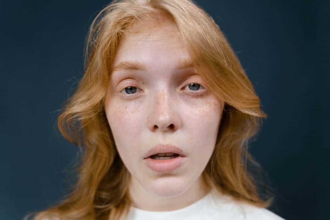 Electrolysis Before And After: 5 Astonishing Things To Know - Icy Health