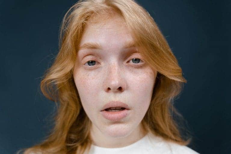 Electrolysis Before And After 5 Astonishing Facts