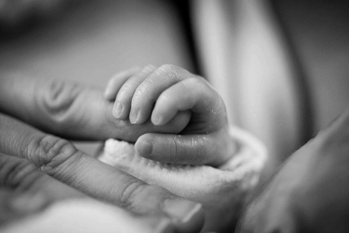 Congenital Anomaly Exploring Types And Treatment Options
