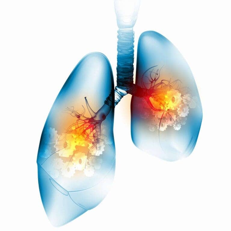 What Do Low CO2 Levels In Blood Indicate