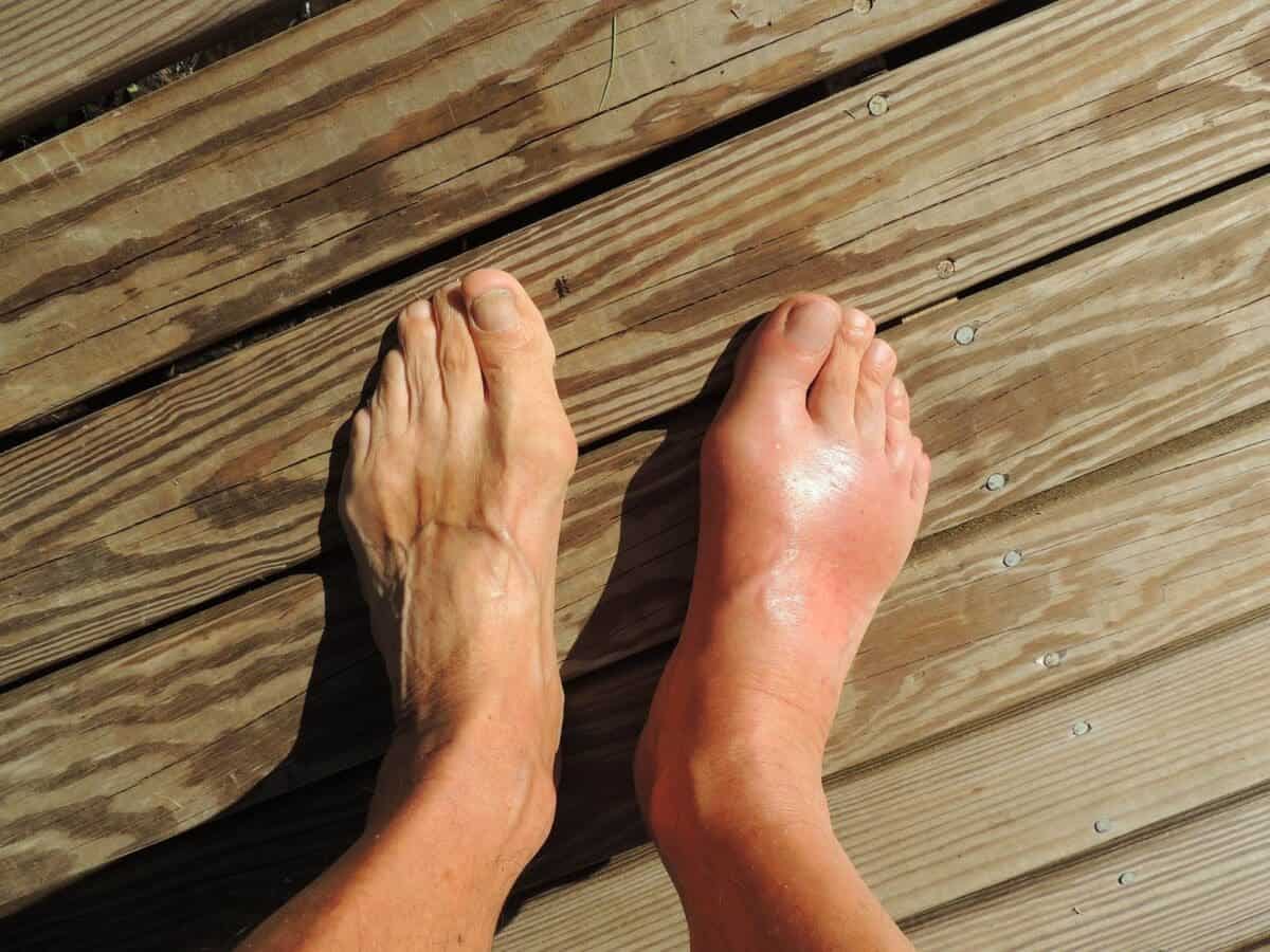 knee and ankle pain