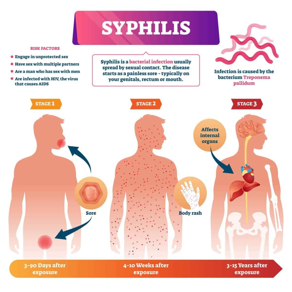 syphilis